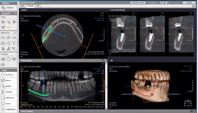 Dental x-ray diagnostic volumetric cone beam