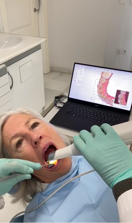 Intraoral Dental Scanner at Clinica Dental Moraira